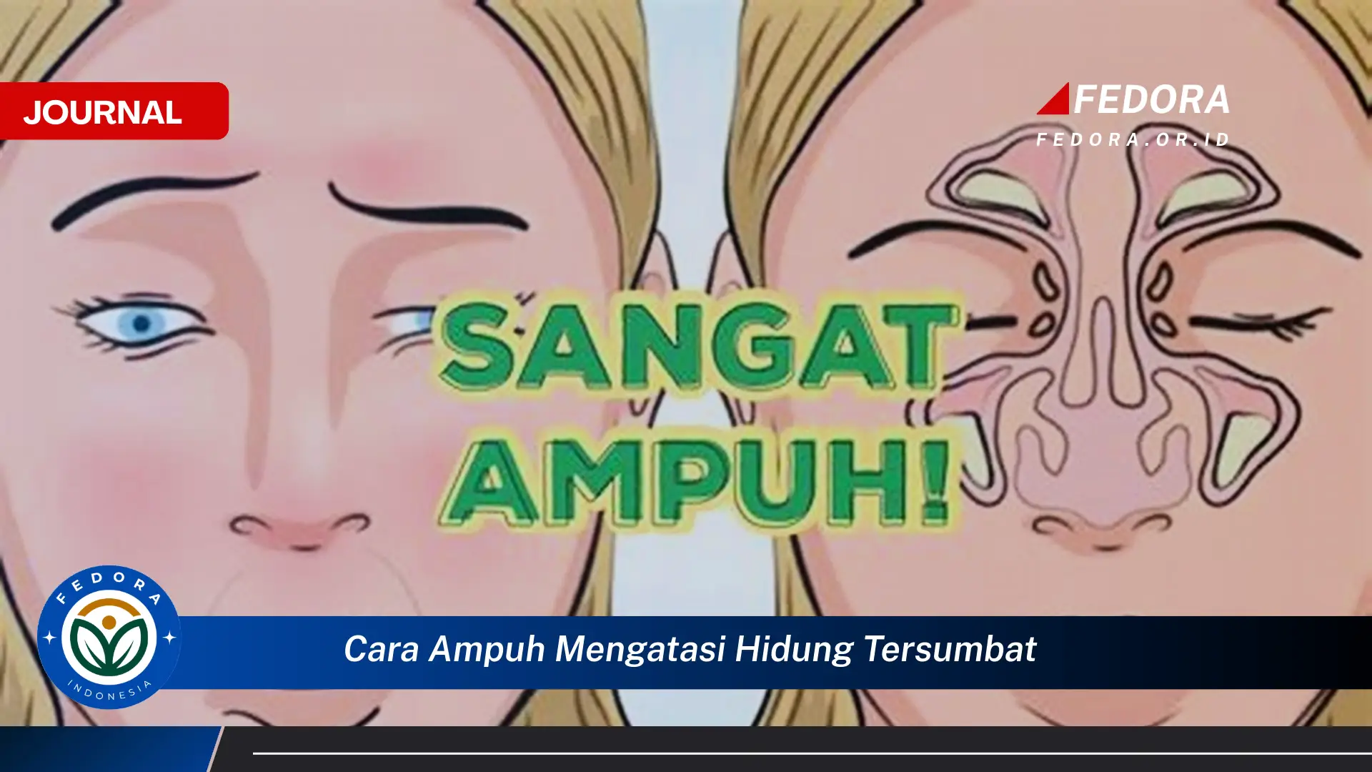 Ketahui Cara Ampuh Mengatasi Hidung Tersumbat Secara Alami dan Cepat