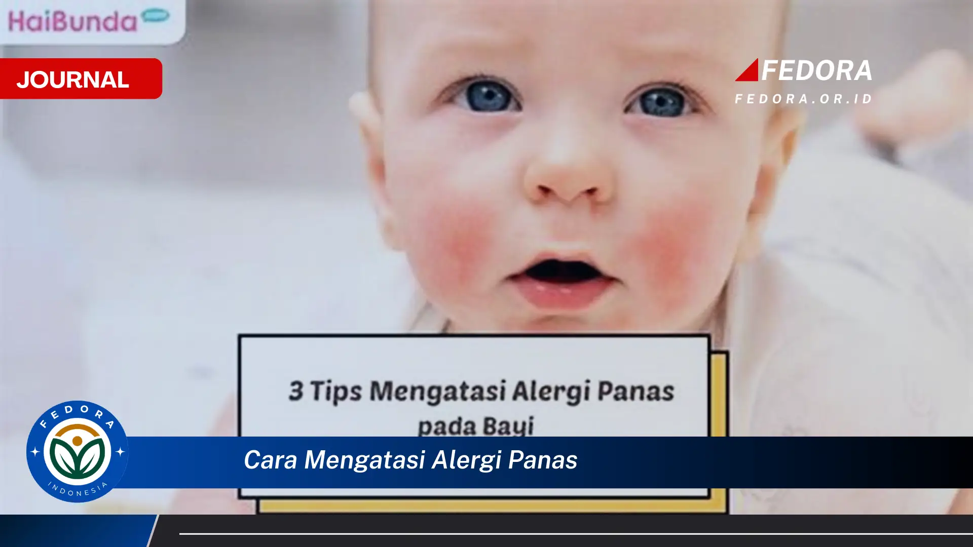 Ketahui Cara Ampuh Mengatasi Alergi Panas pada Kulit Anda