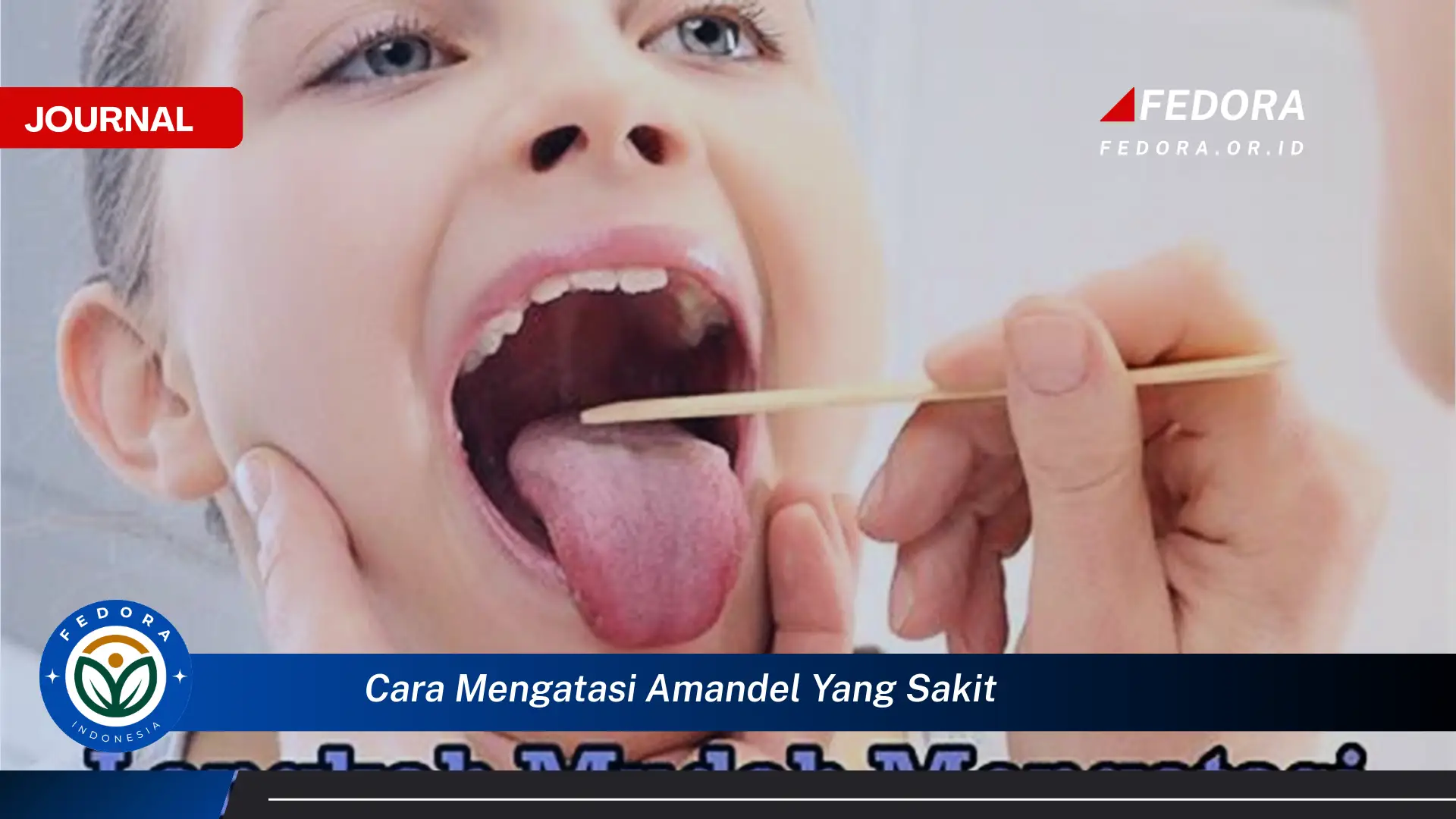 Ketahui Cara Mengatasi Amandel yang Sakit Secara Alami dan Efektif