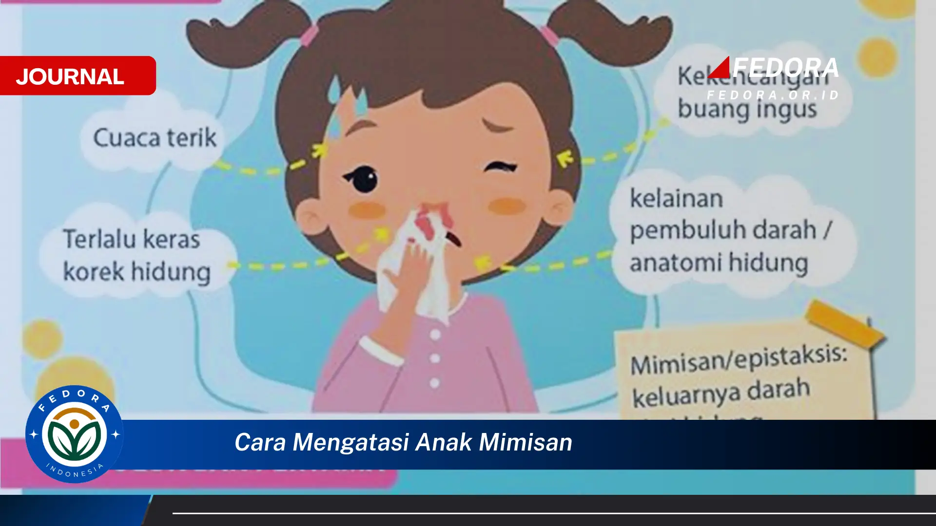 Ketahui Cara Mengatasi Mimisan pada Anak Secara Efektif dan Aman