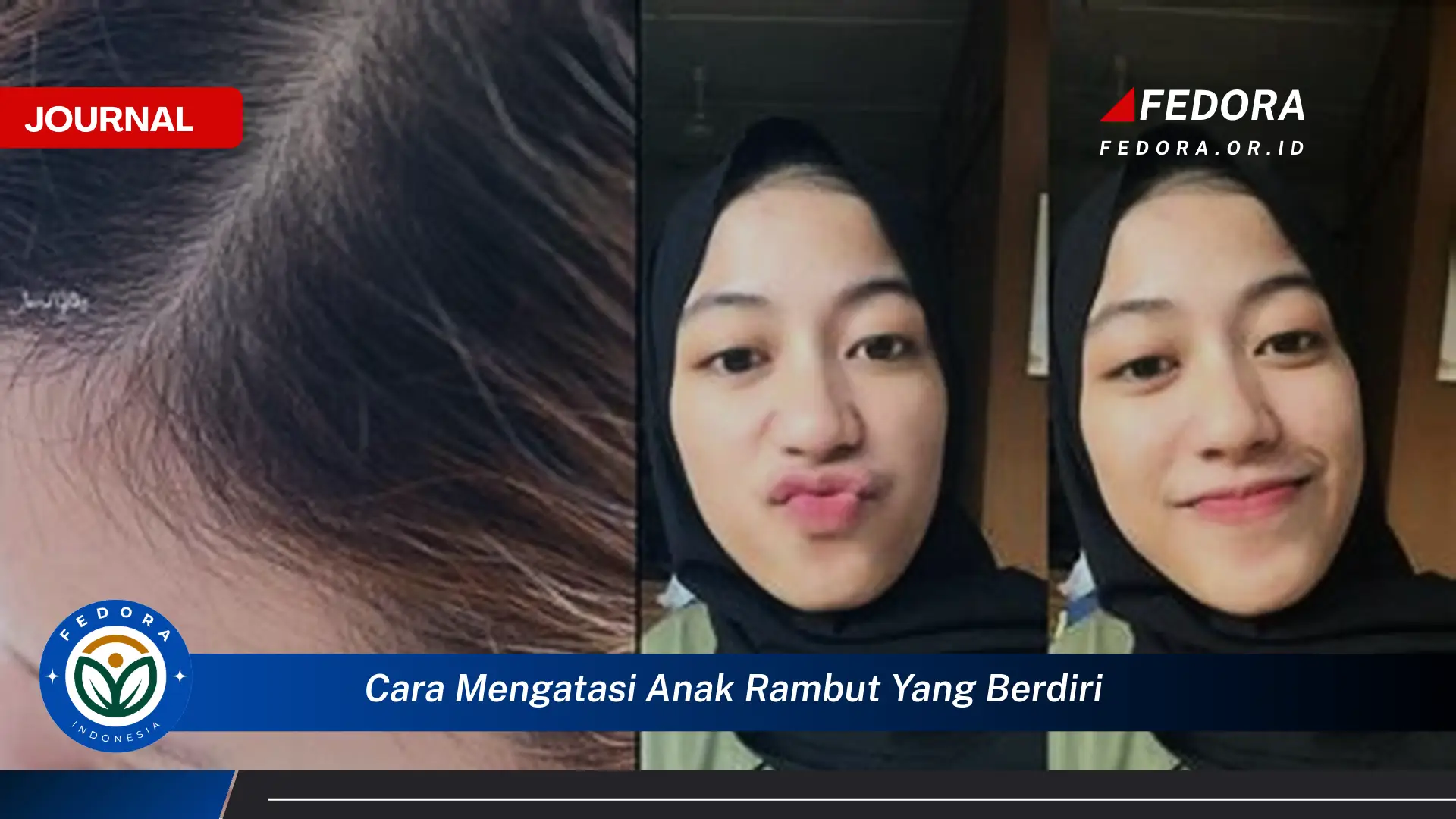 Ketahui Cara Mengatasi Anak Rambut yang Berdiri dan Mengembang Secara Alami