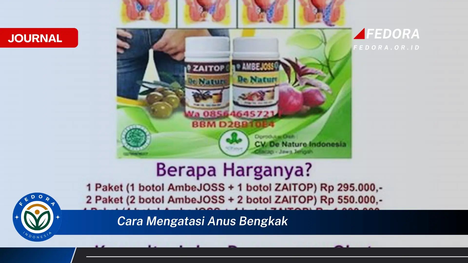 Ketahui Cara Mengatasi Anus Bengkak Secara Efektif dan Alami