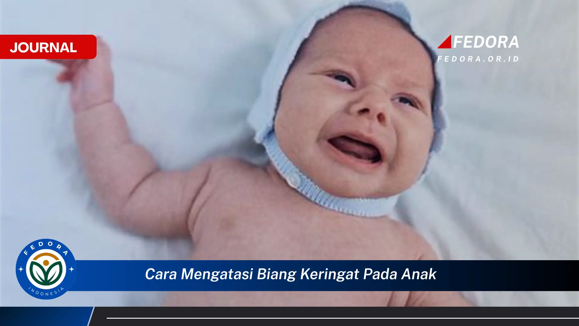 Ketahui Cara Mengatasi Biang Keringat pada Anak Secara Efektif dan Alami