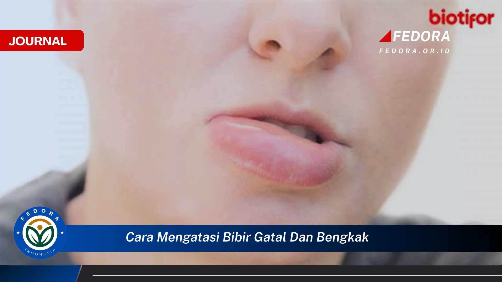 Ketahui Cara Mengatasi Bibir Gatal dan Bengkak Secara Cepat dan Alami