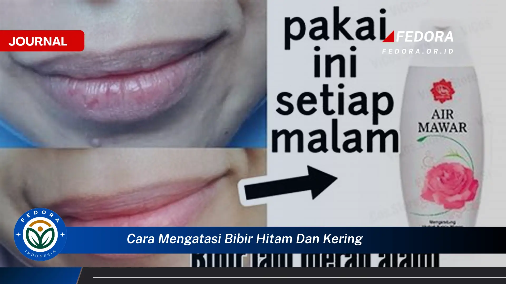 Ketahui Cara Mengatasi Bibir Hitam dan Kering Secara Alami dan Cepat