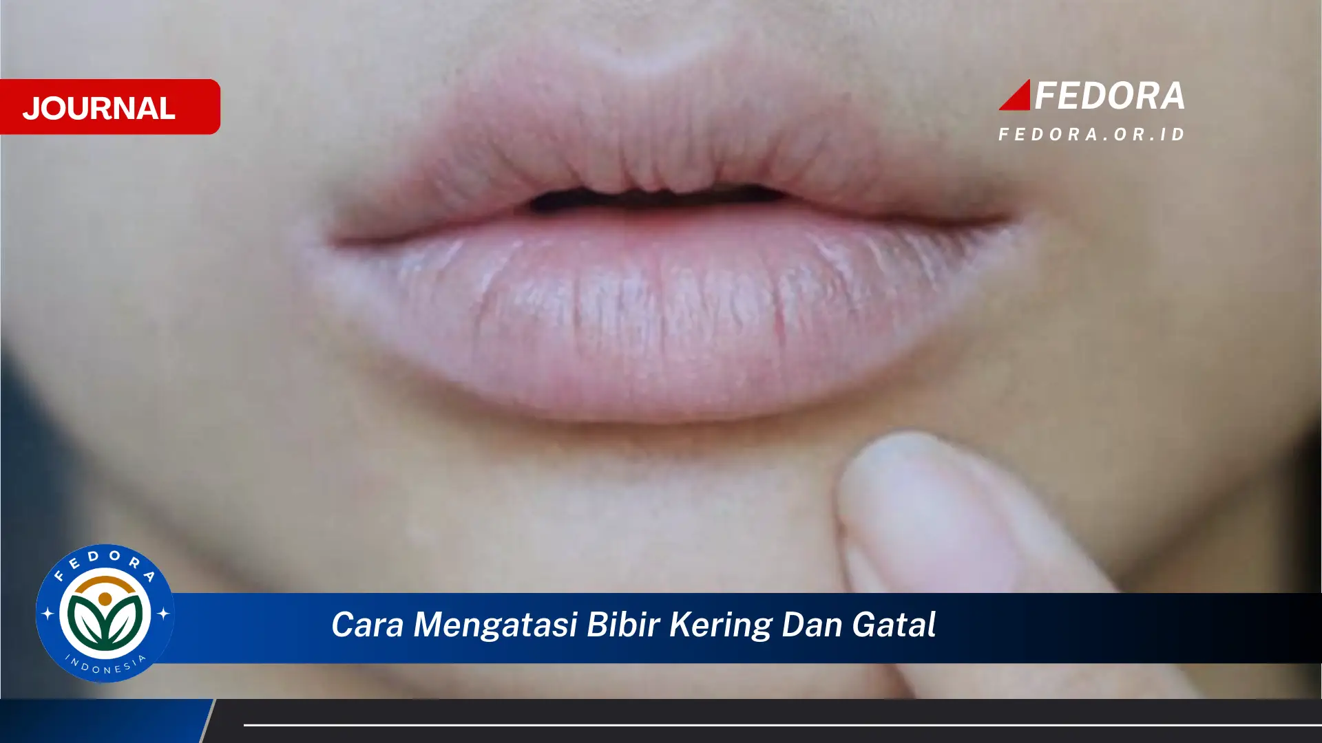 Ketahui Cara Mengatasi Bibir Kering dan Gatal Secara Cepat dan Alami