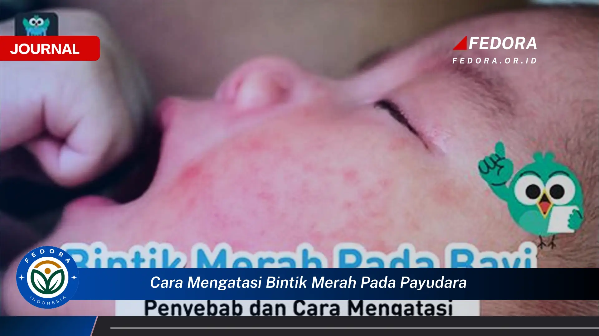 Ketahui Cara Mengatasi Bintik Merah Pada Payudara dan Penyebab Umumnya