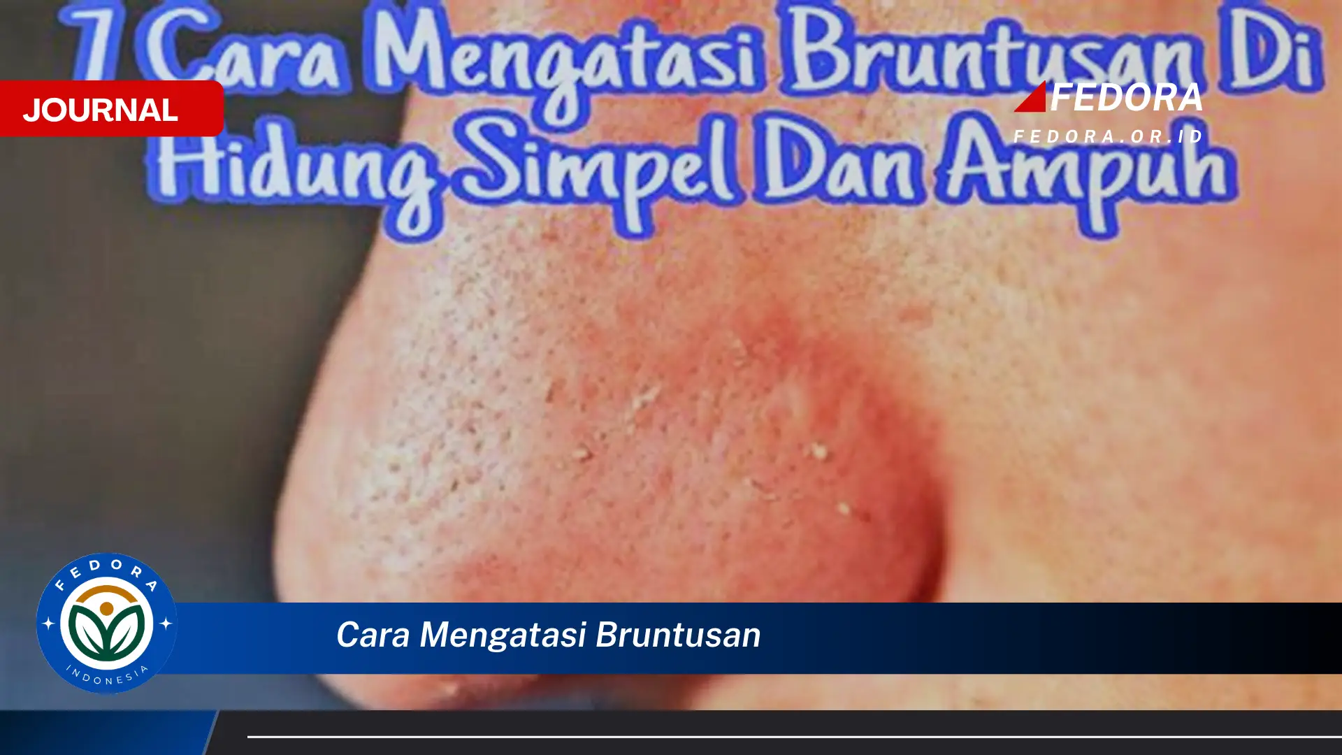 Ketahui Cara Mengatasi Bruntusan dengan Cepat dan Ampuh