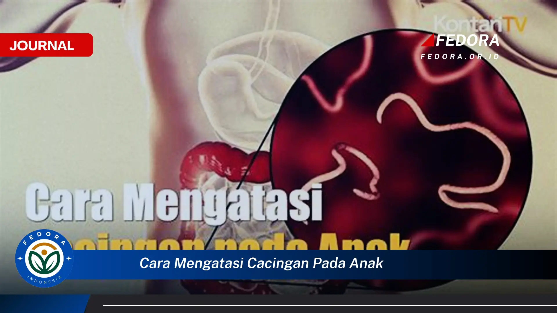 Ketahui Cara Mengatasi Cacingan Pada Anak Secara Efektif dan Alami