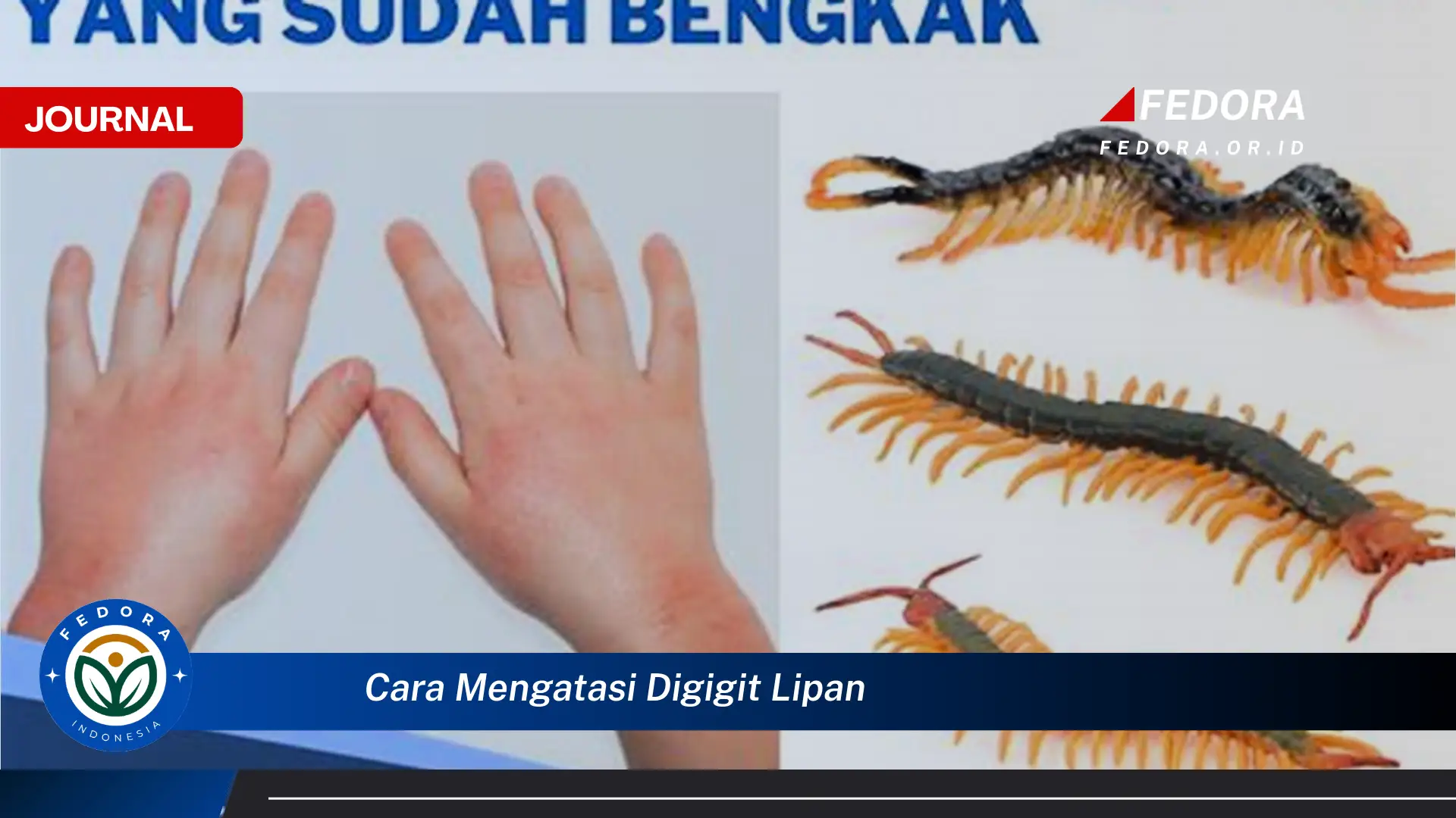 Ketahui Cara Mengatasi Gigitan Lipan dengan Cepat dan Efektif untuk Meredakan Nyeri dan Bengkak