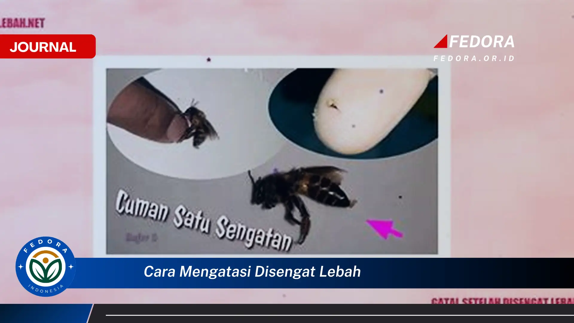 Ketahui Cara Mengatasi Disengat Lebah dengan Cepat dan Aman