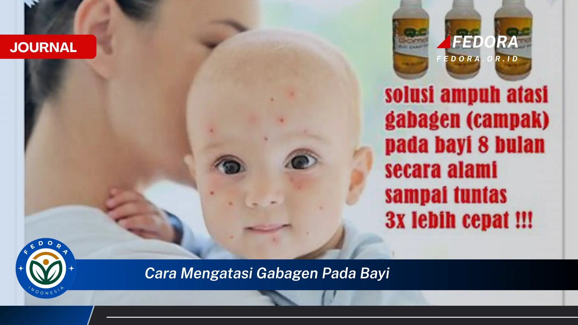 Ketahui Cara Mengatasi Gabagen pada Bayi Secara Efektif dan Alami