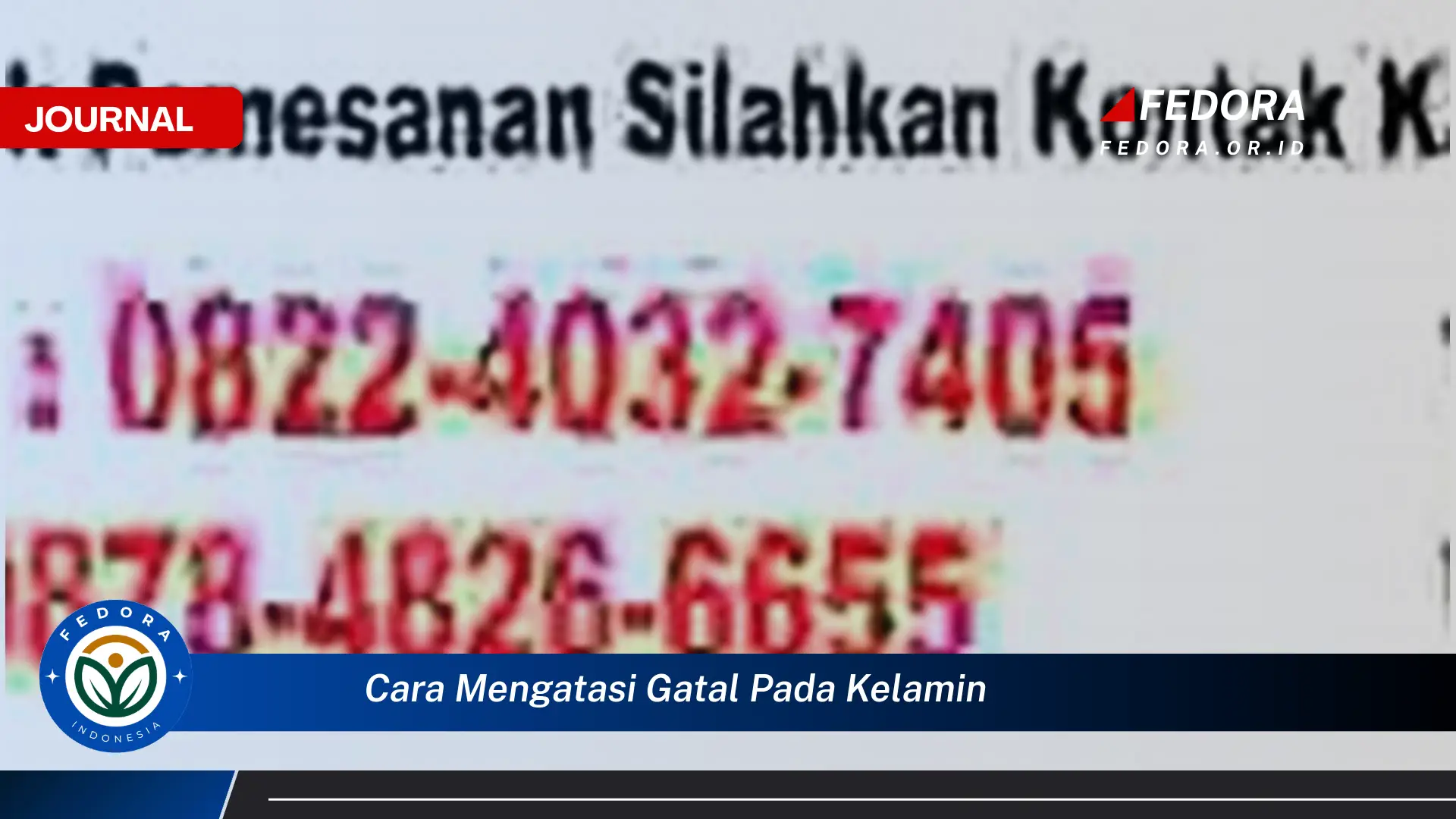 Ketahui Cara Mengatasi Gatal Pada Kelamin Dengan Cepat dan Aman