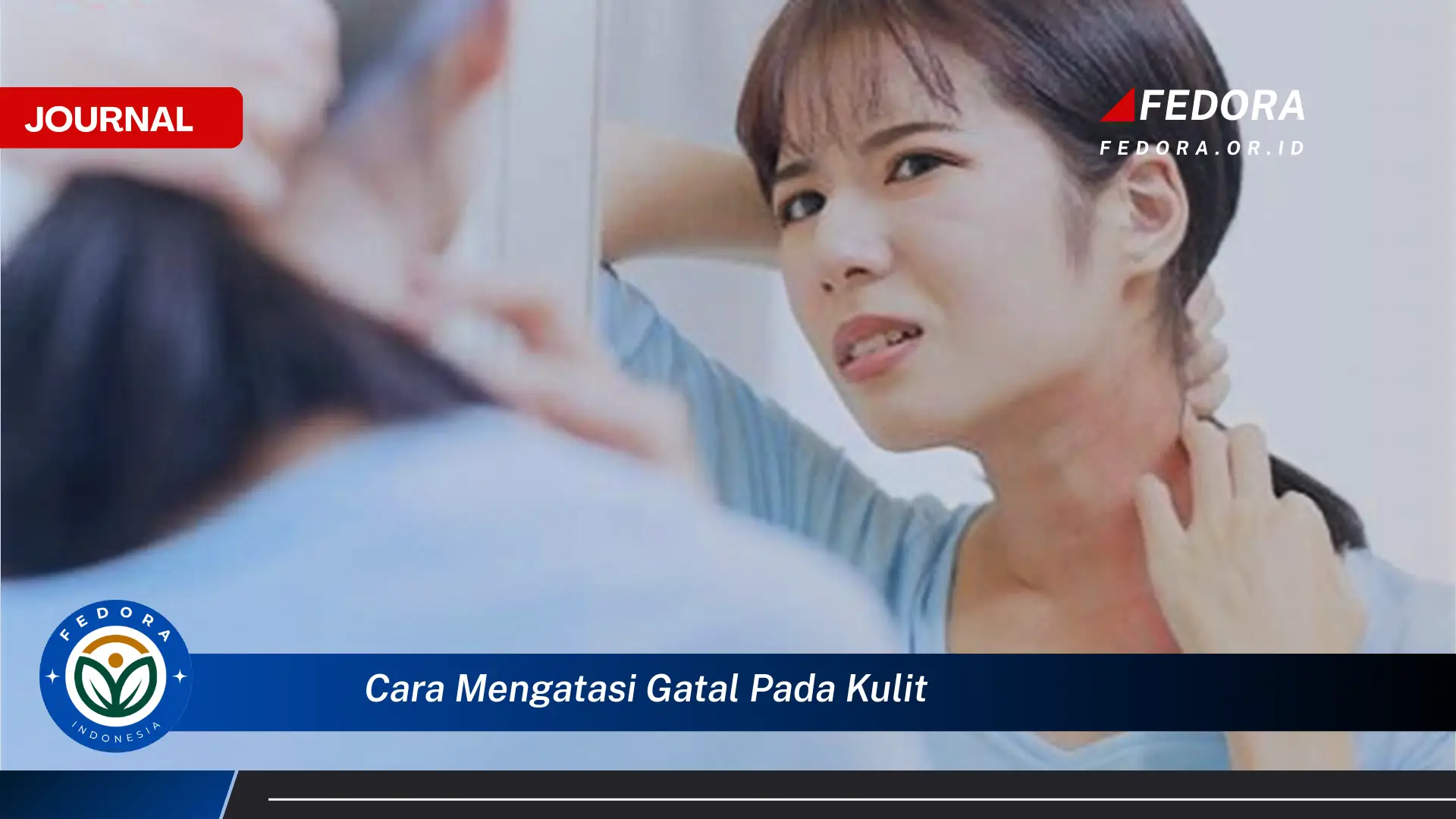 Ketahui Cara Mengatasi Gatal Pada Kulit Secara Cepat dan Alami