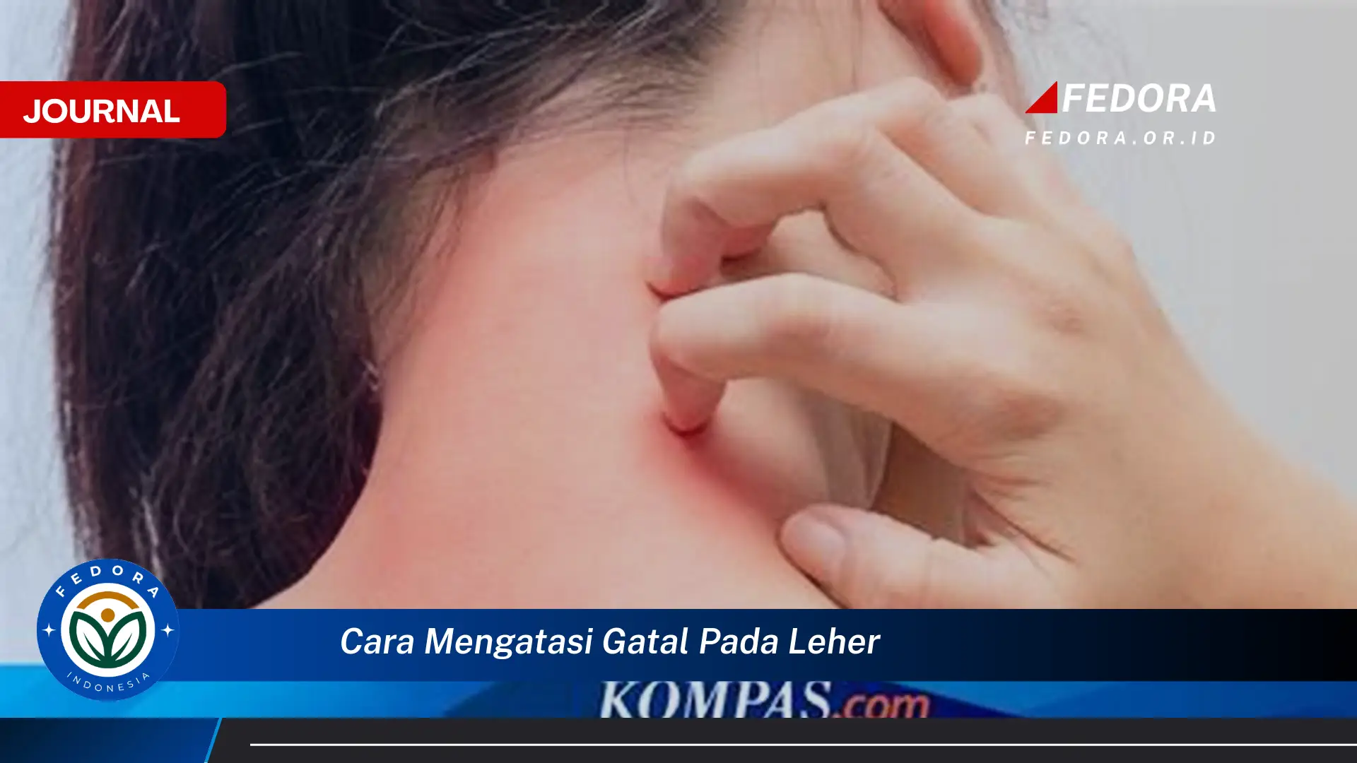 Ketahui Cara Mengatasi Gatal pada Leher dengan Cepat dan Ampuh Ketahui Cara Mengatasi Gatal pada Leher dengan Cepat dan Ampuh