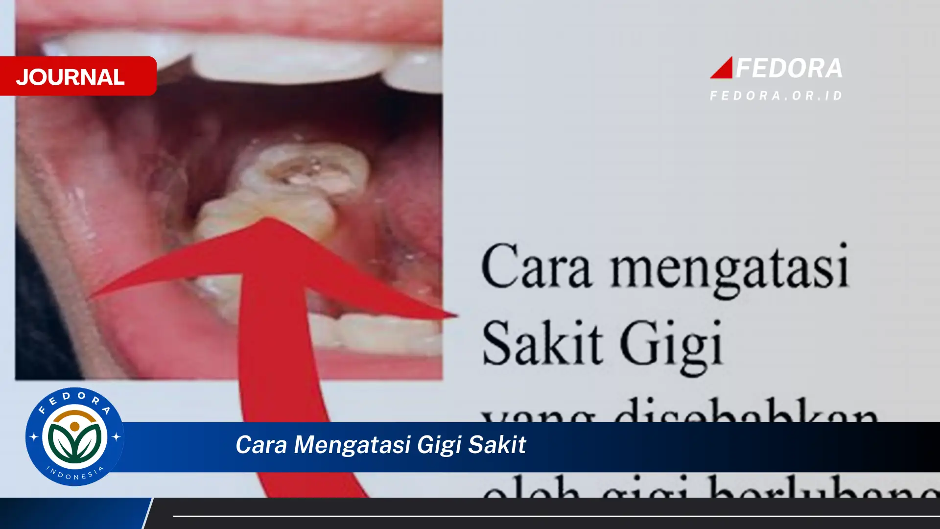 Ketahui Cara Mengatasi Gigi Sakit dengan Cepat dan Alami di Rumah