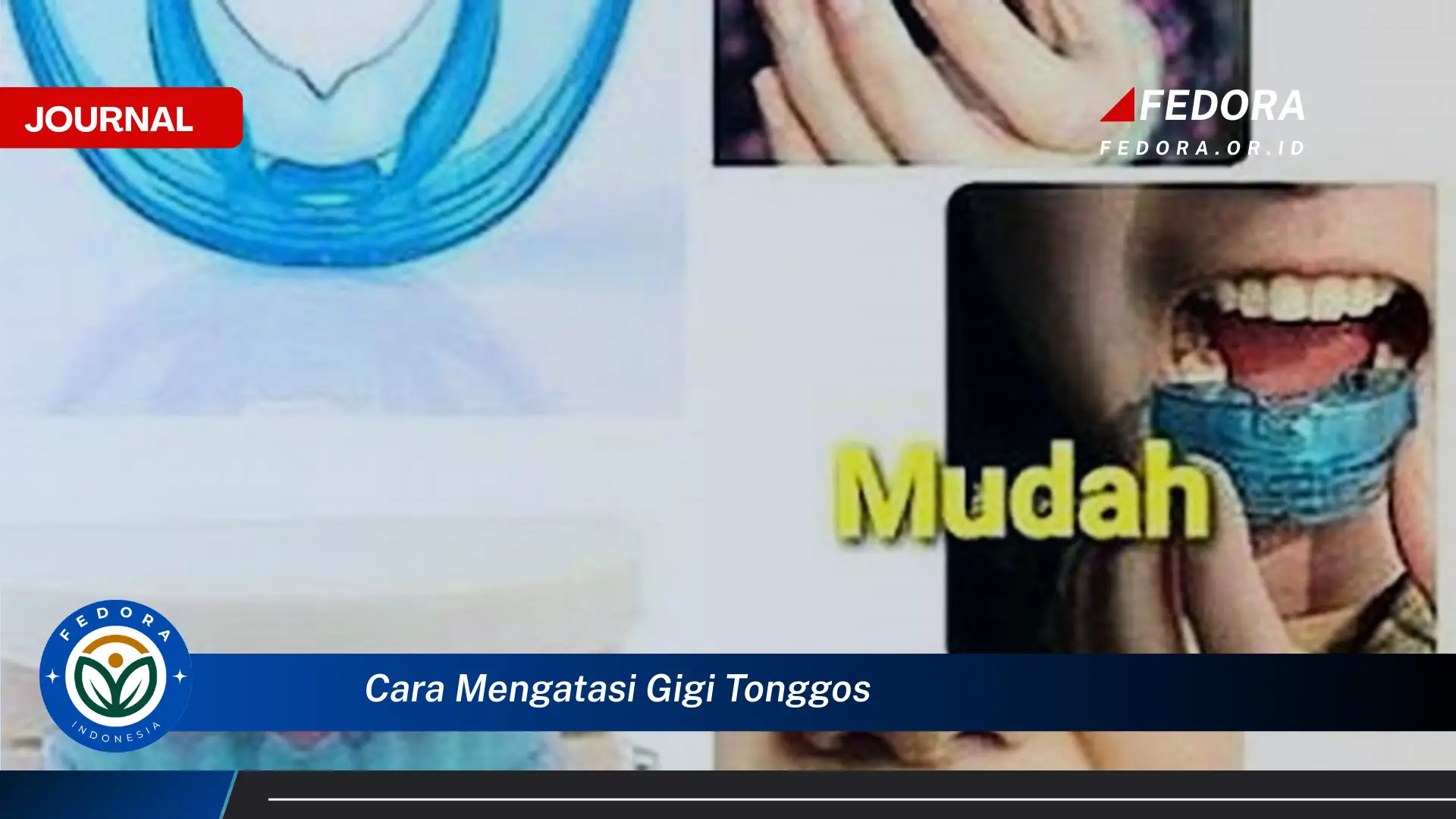 Ketahui Cara Mengatasi Gigi Tonggos Secara Efektif dan Alami