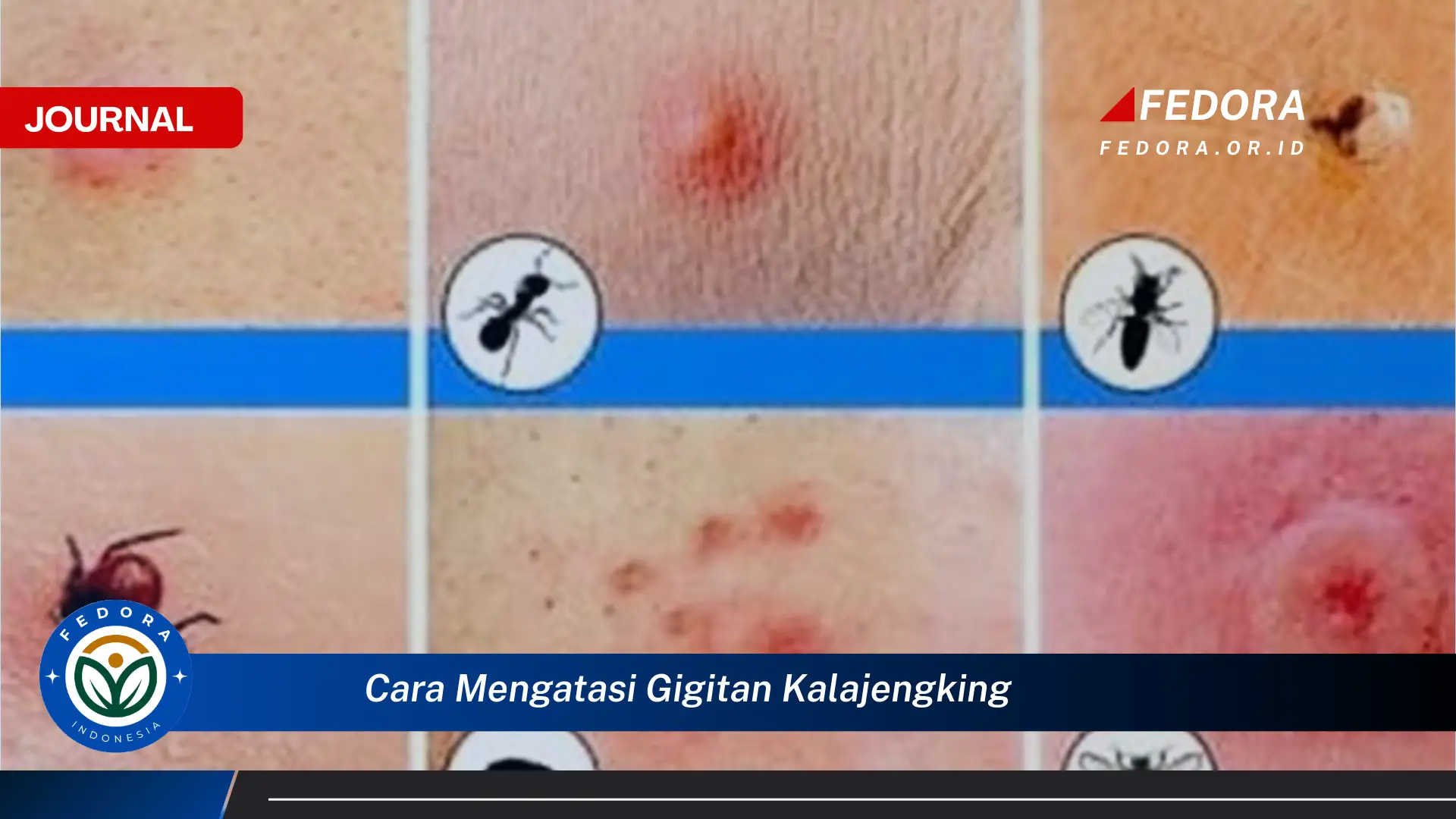 Pertolongan Pertama Pada Gigitan Kalajengking, Panduan Lengkap dan Efektif