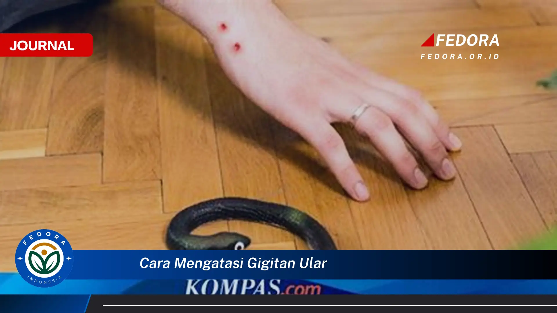 Ketahui Cara Mengatasi Gigitan Ular, Pertolongan Pertama yang Harus Dilakukan