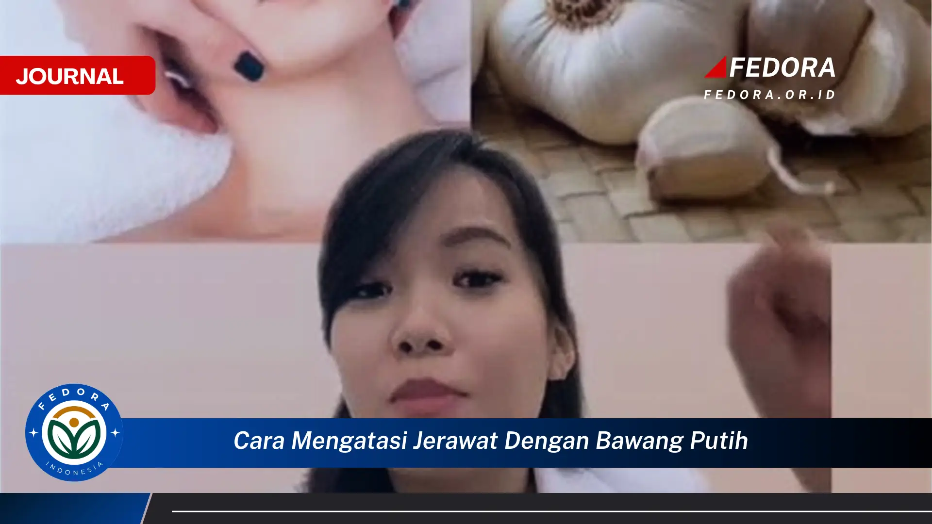 Ketahui Cara Mengatasi Jerawat dengan Bawang Putih, Ampuh dan Alami untuk Kulit Bersih Bersinar