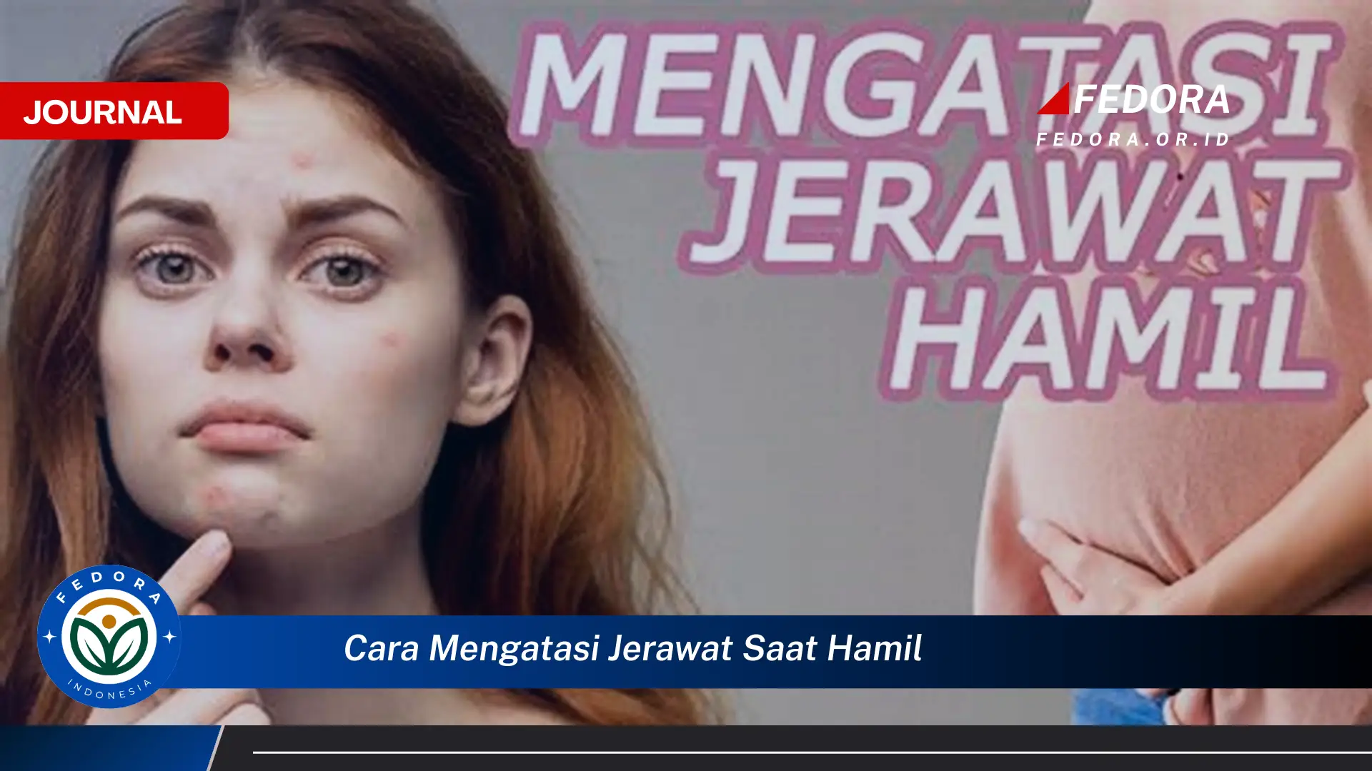 Ketahui Cara Mengatasi Jerawat Saat Hamil yang Aman dan Efektif