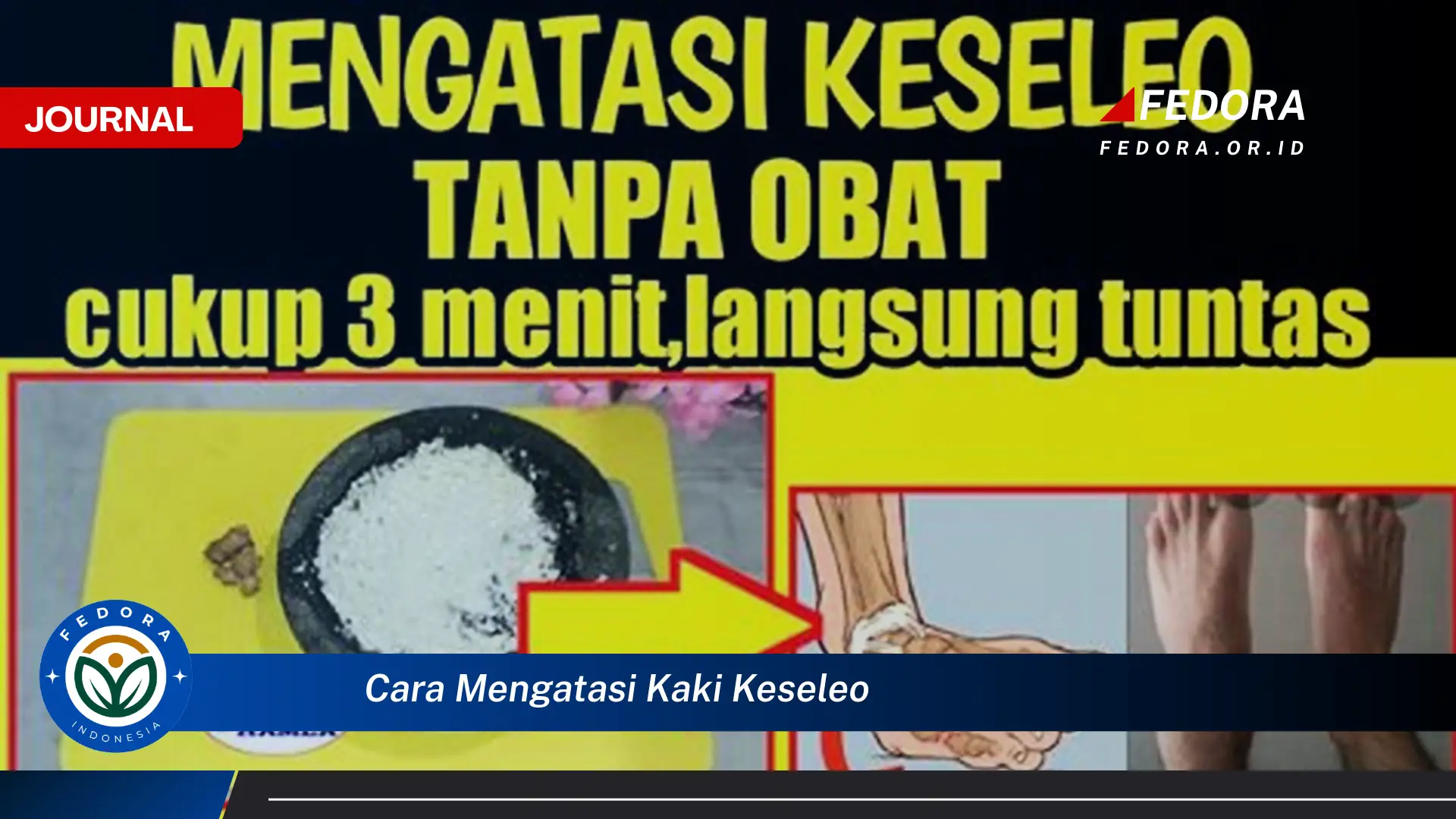 Ketahui Cara Mengatasi Kaki Keseleo dengan Cepat dan Efektif