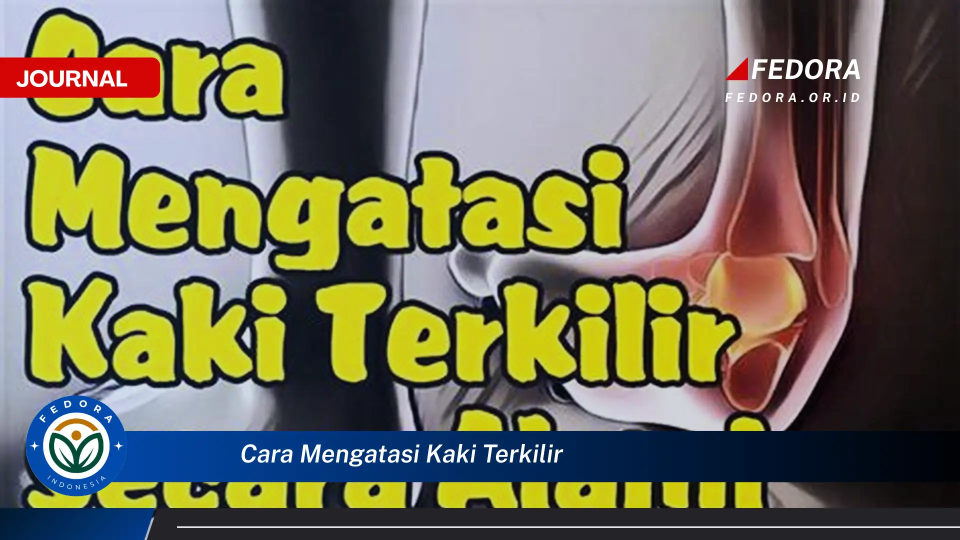 Ketahui Cara Mengatasi Kaki Terkilir, Panduan Lengkap dari Pertolongan Pertama Hingga Pemulihan