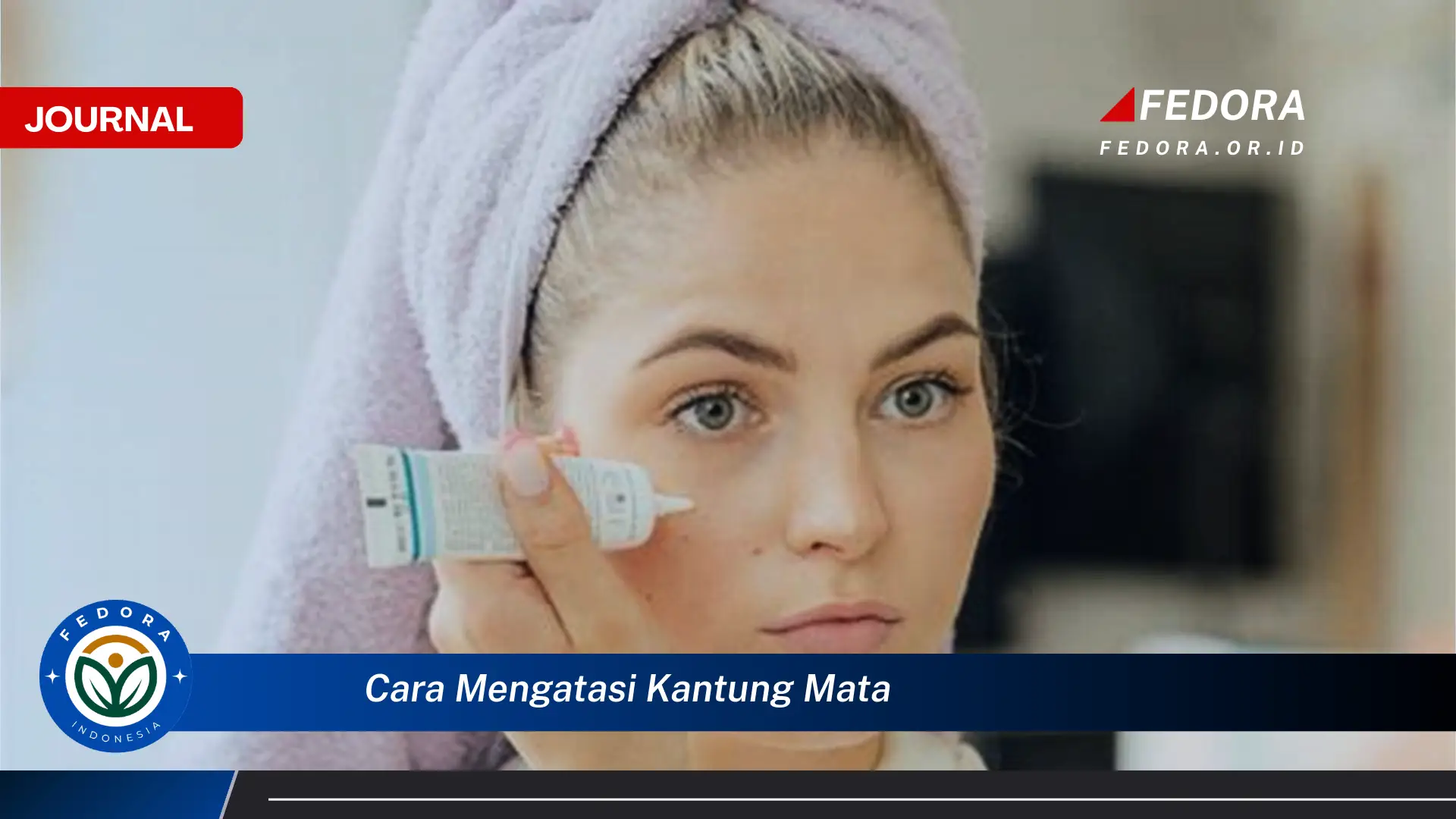 Ketahui Cara Mengatasi Kantung Mata Secara Alami dan Efektif