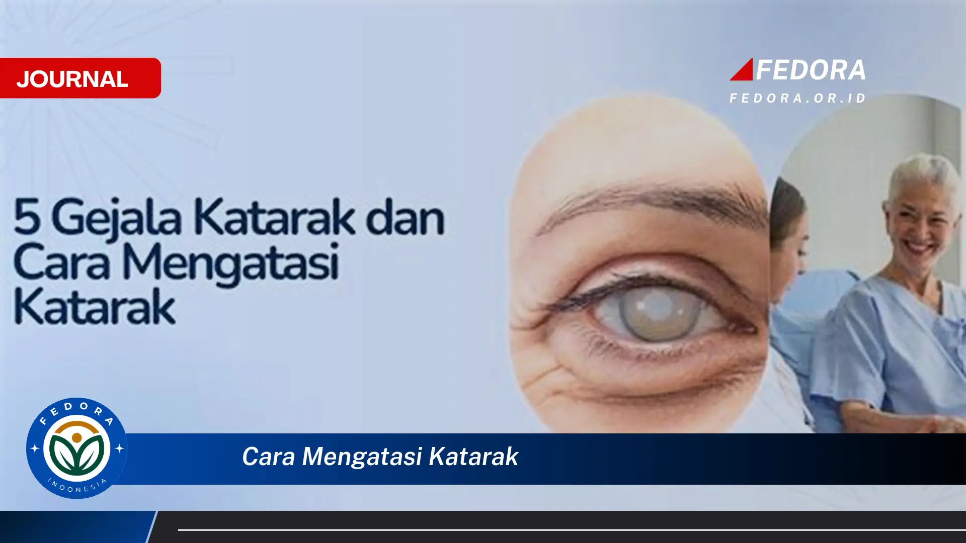 Ketahui Cara Mengatasi Katarak Secara Efektif dan Aman