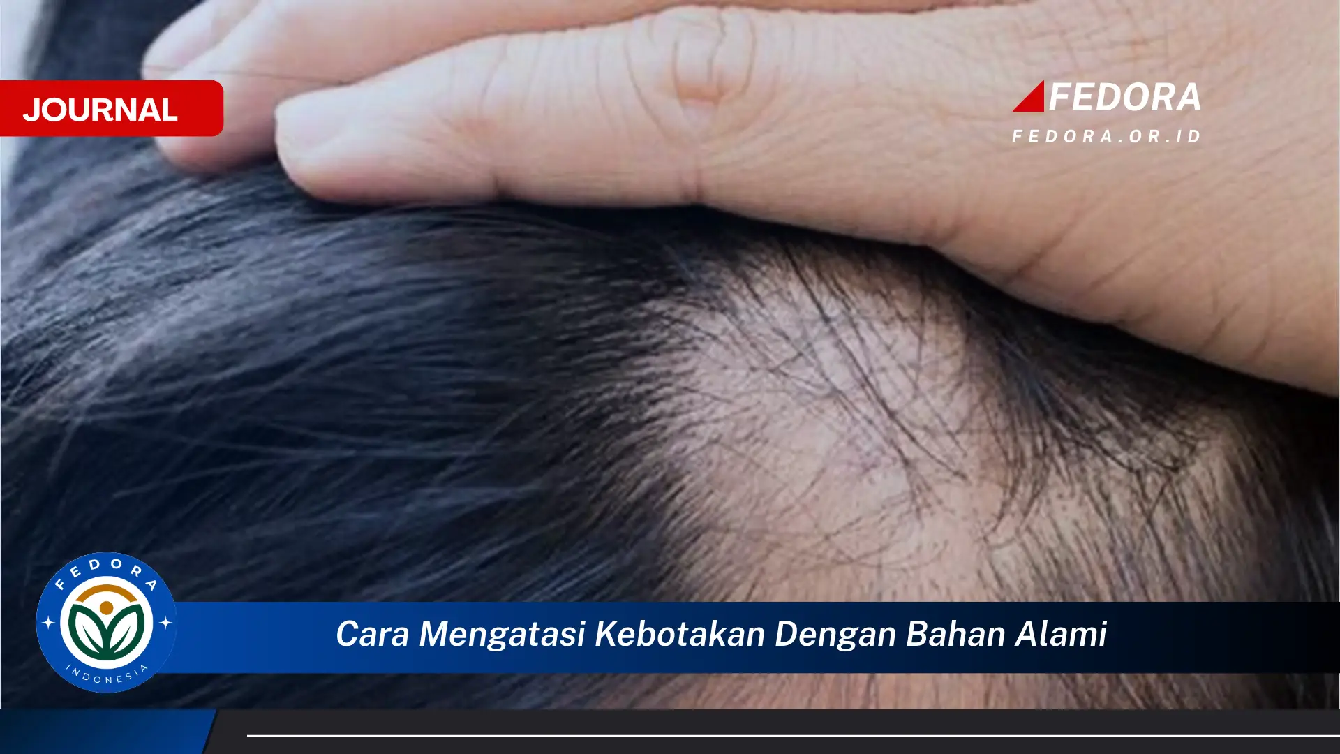 Ketahui Cara Mengatasi Kebotakan dengan Bahan Alami Secara Efektif