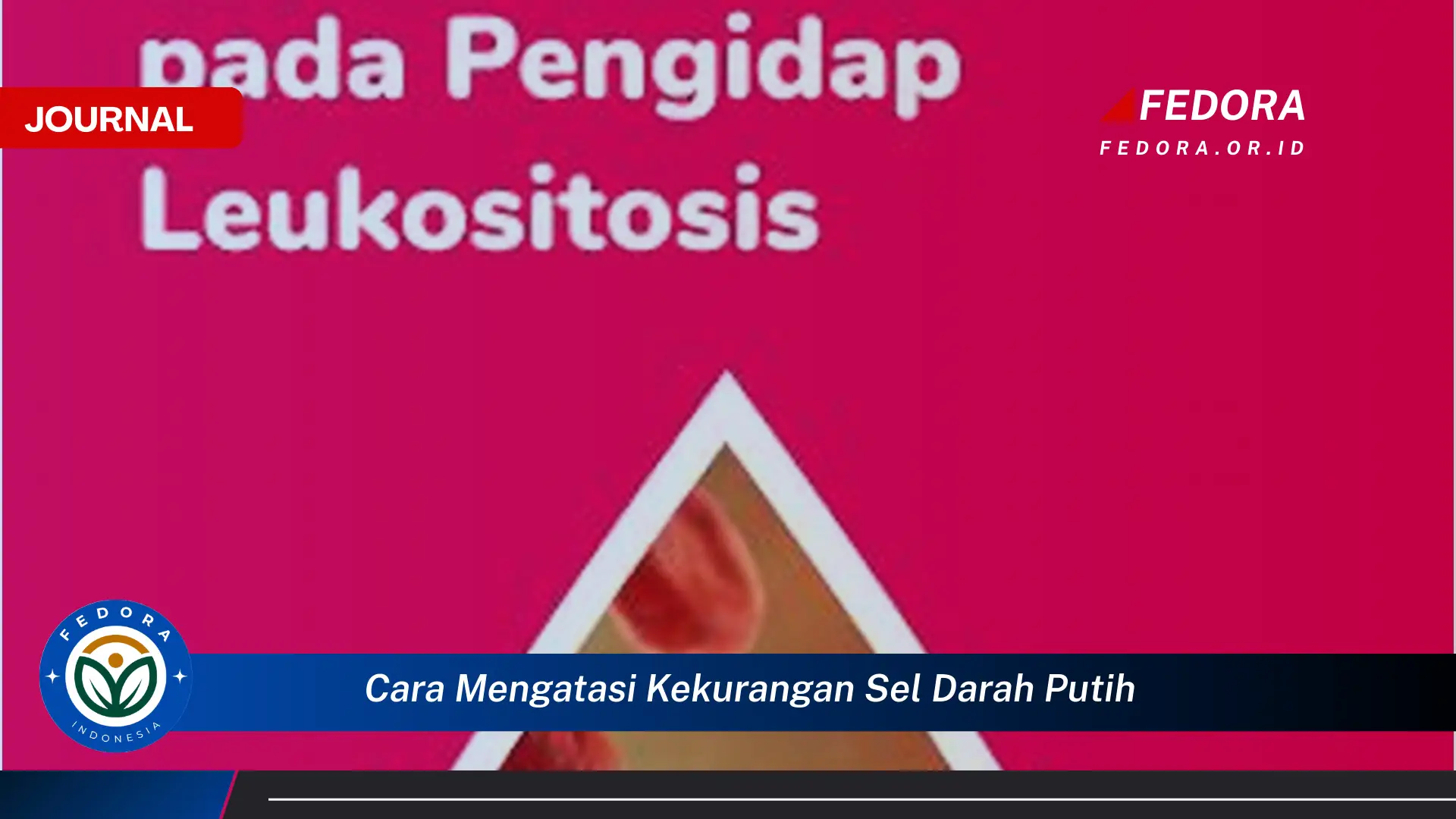 Temukan Cara Mengatasi Kekurangan Sel Darah Putih Secara Alami dan Medis Temukan Cara Mengatasi Kekurangan Sel Darah Putih Secara Alami dan Medis