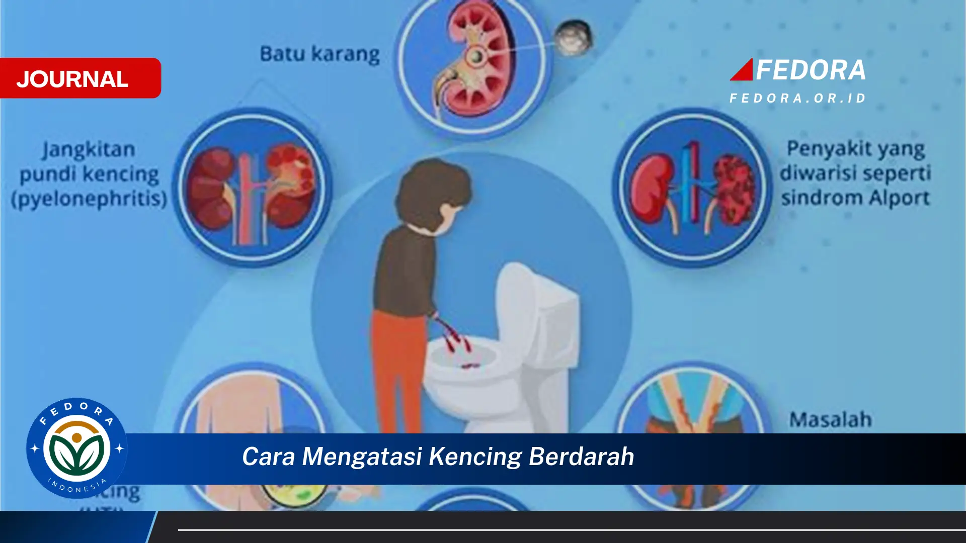 Ketahui Cara Mengatasi Kencing Berdarah Secara Efektif dan Aman