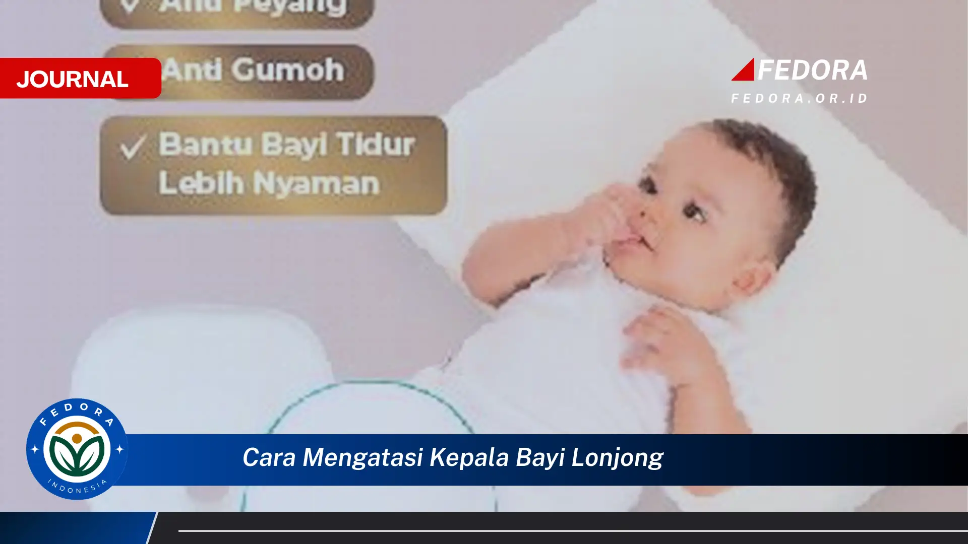 Ketahui Cara Mengatasi Kepala Bayi Lonjong Secara Efektif dan Aman