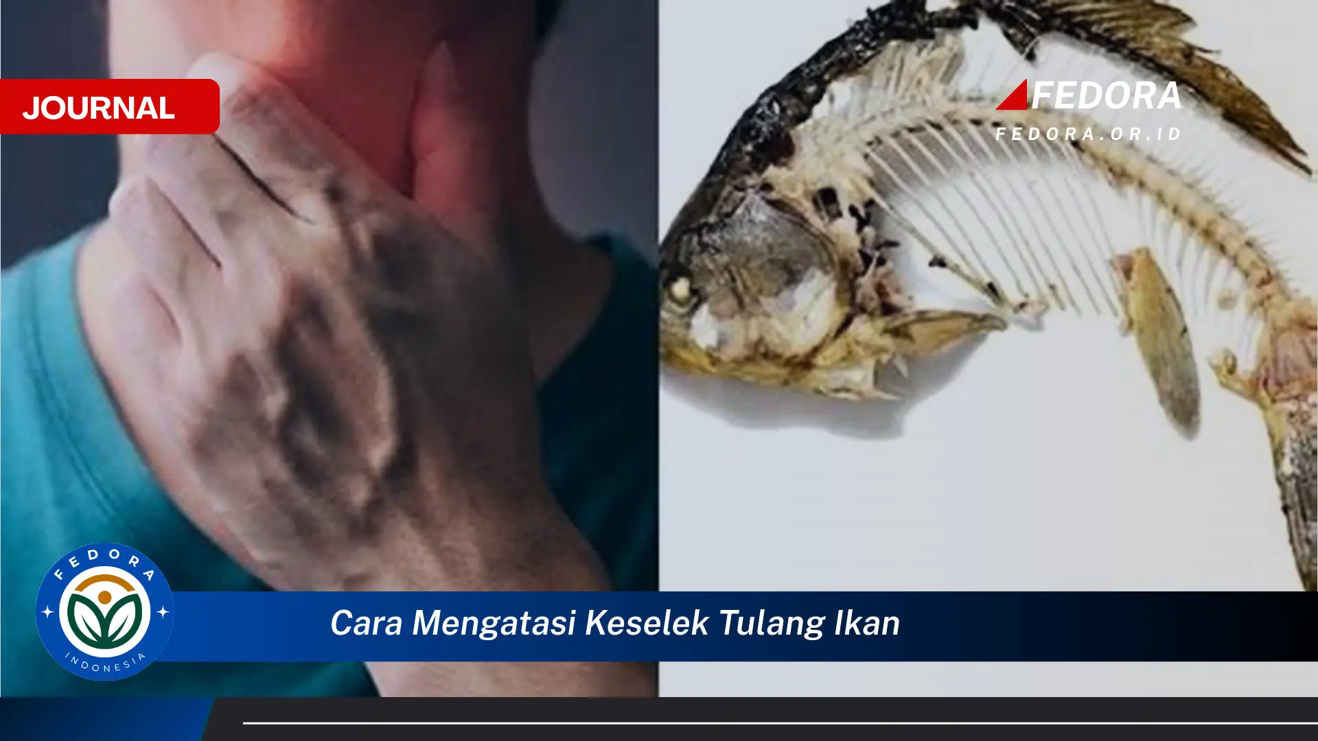Ketahui Cara Mengatasi Keselek Tulang Ikan dengan Cepat dan Aman Ketahui Cara Mengatasi Keselek Tulang Ikan dengan Cepat dan Aman