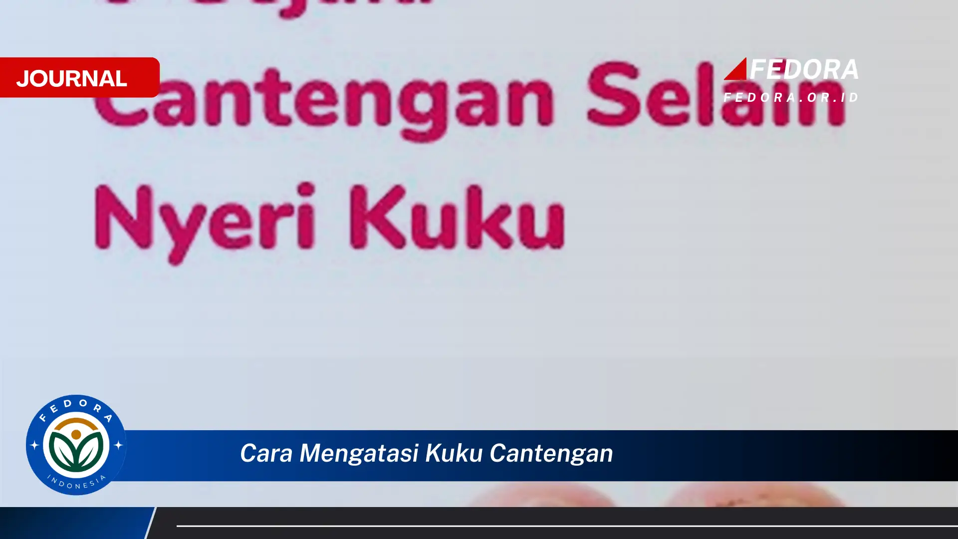 Ketahui Cara Mengatasi Kuku Cantengan dengan Cepat dan Efektif