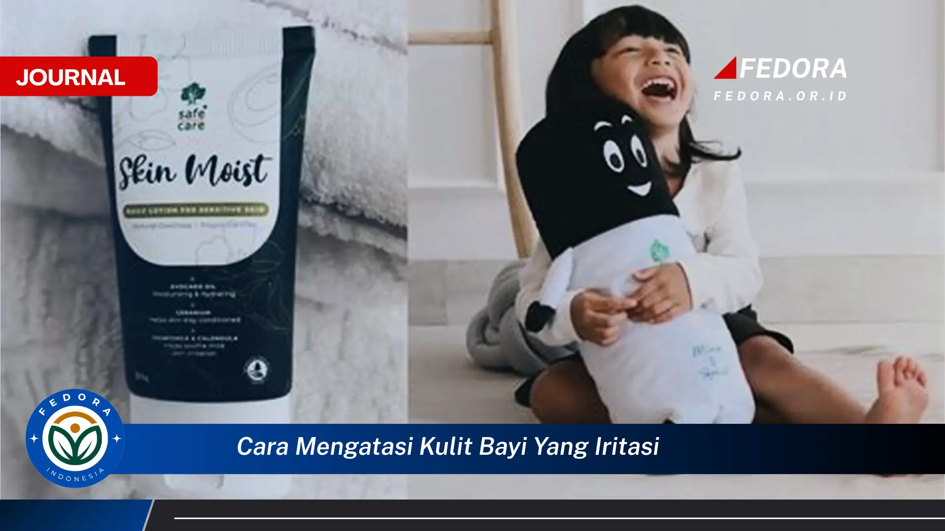 Ketahui Cara Mengatasi Kulit Bayi yang Iritasi Secara Efektif dan Alami