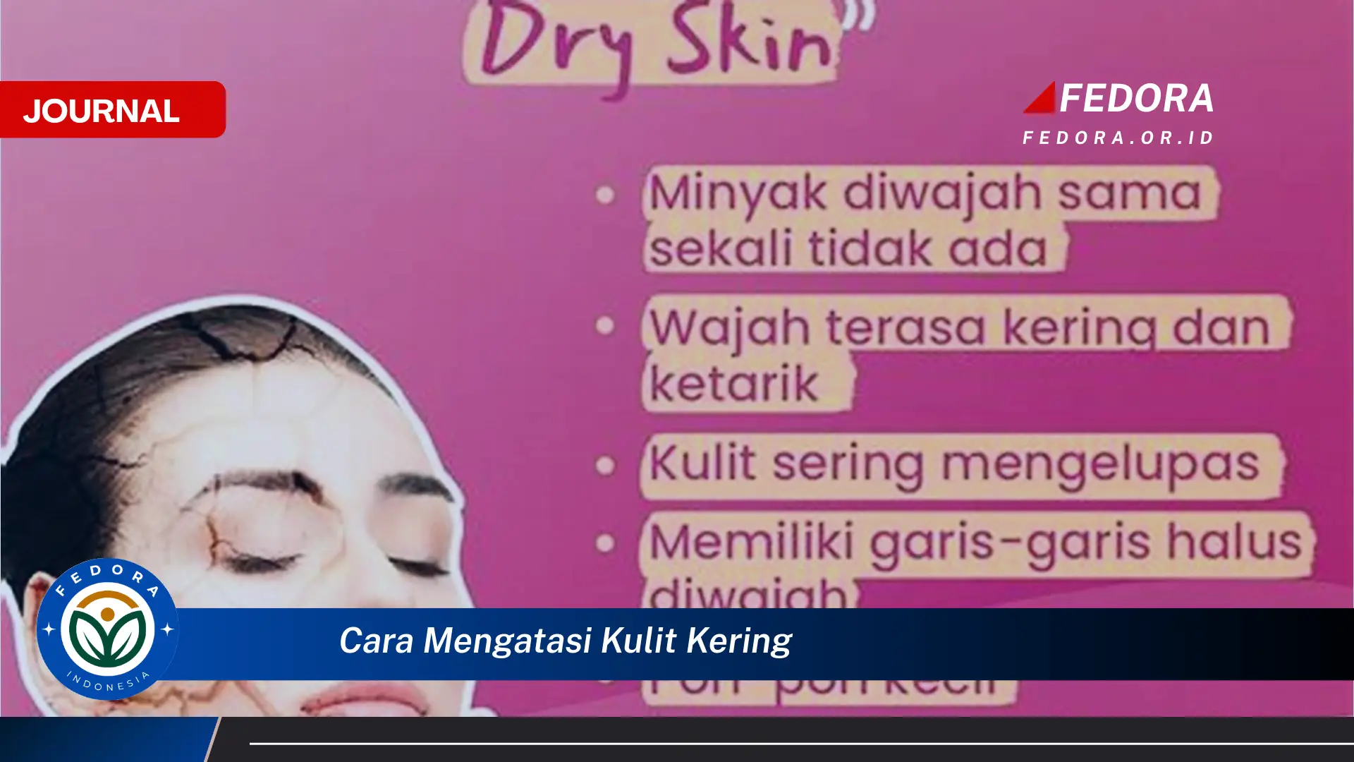 Ketahui Cara Mengatasi Kulit Kering Secara Efektif dan Alami Ketahui Cara Mengatasi Kulit Kering Secara Efektif dan Alami