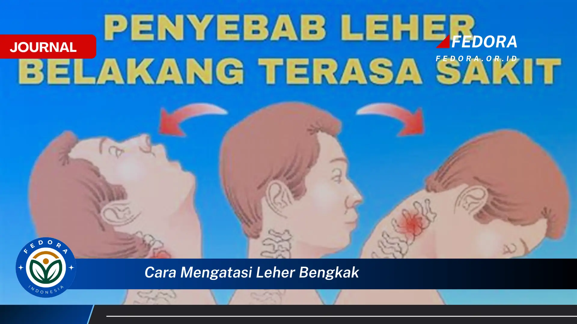 Ketahui Cara Mengatasi Leher Bengkak Secara Efektif dan Alami