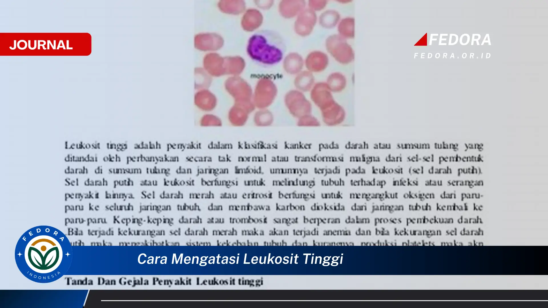 Ketahui Cara Mengatasi Leukosit Tinggi Secara Alami dan Efektif Ketahui Cara Mengatasi Leukosit Tinggi Secara Alami dan Efektif