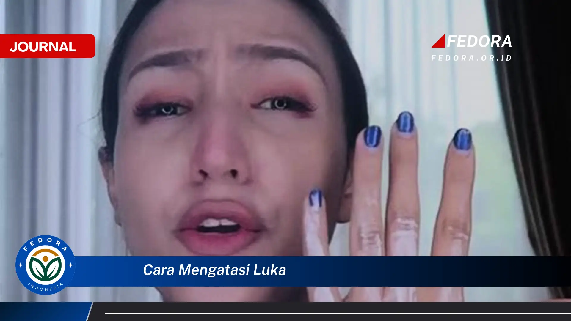 Ketahui Cara Mengatasi Luka dengan Cepat dan Efektif