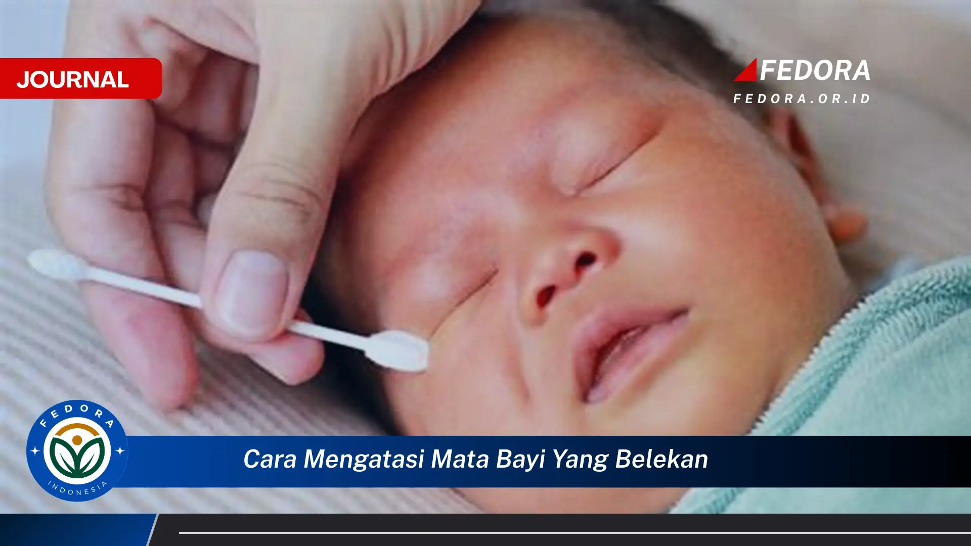 Ketahui Cara Mengatasi Mata Bayi yang Belekan Secara Efektif dan Cepat