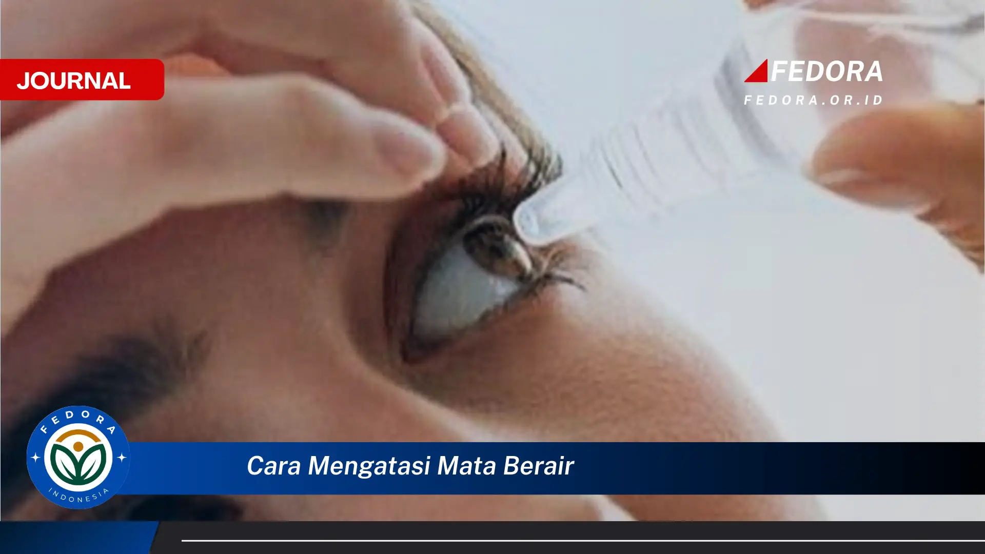 Ketahui Cara Mengatasi Mata Berair Secara Efektif dan Alami