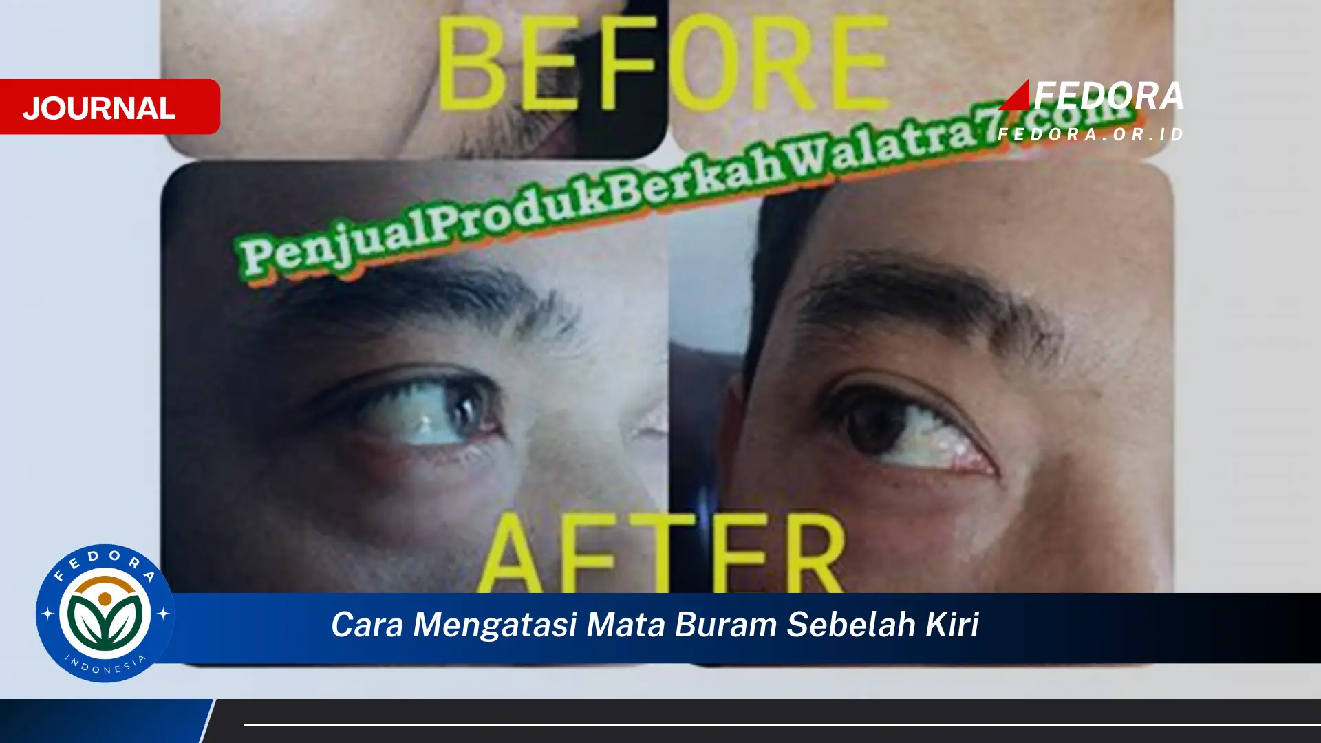 Ketahui Cara Mengatasi Mata Buram Sebelah Kiri, Penyebab dan Solusinya Ketahui Cara Mengatasi Mata Buram Sebelah Kiri, Penyebab dan Solusinya