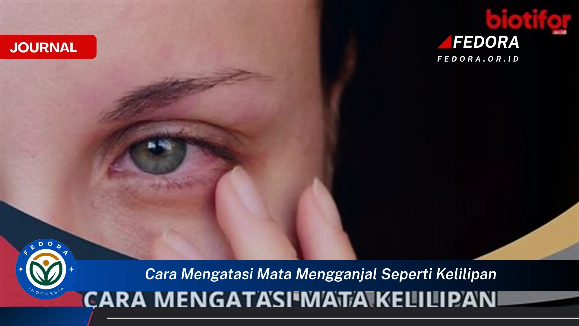 Ketahui Cara Mengatasi Mata Mengganjal Seperti Kelilipan Pertolongan Pertama dan Pencegahan