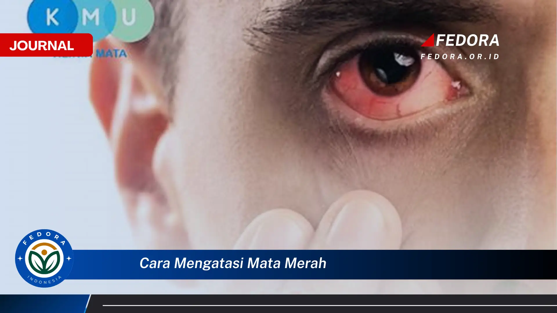 Ketahui Cara Mengatasi Mata Merah dengan Cepat dan Efektif Ketahui Cara Mengatasi Mata Merah dengan Cepat dan Efektif