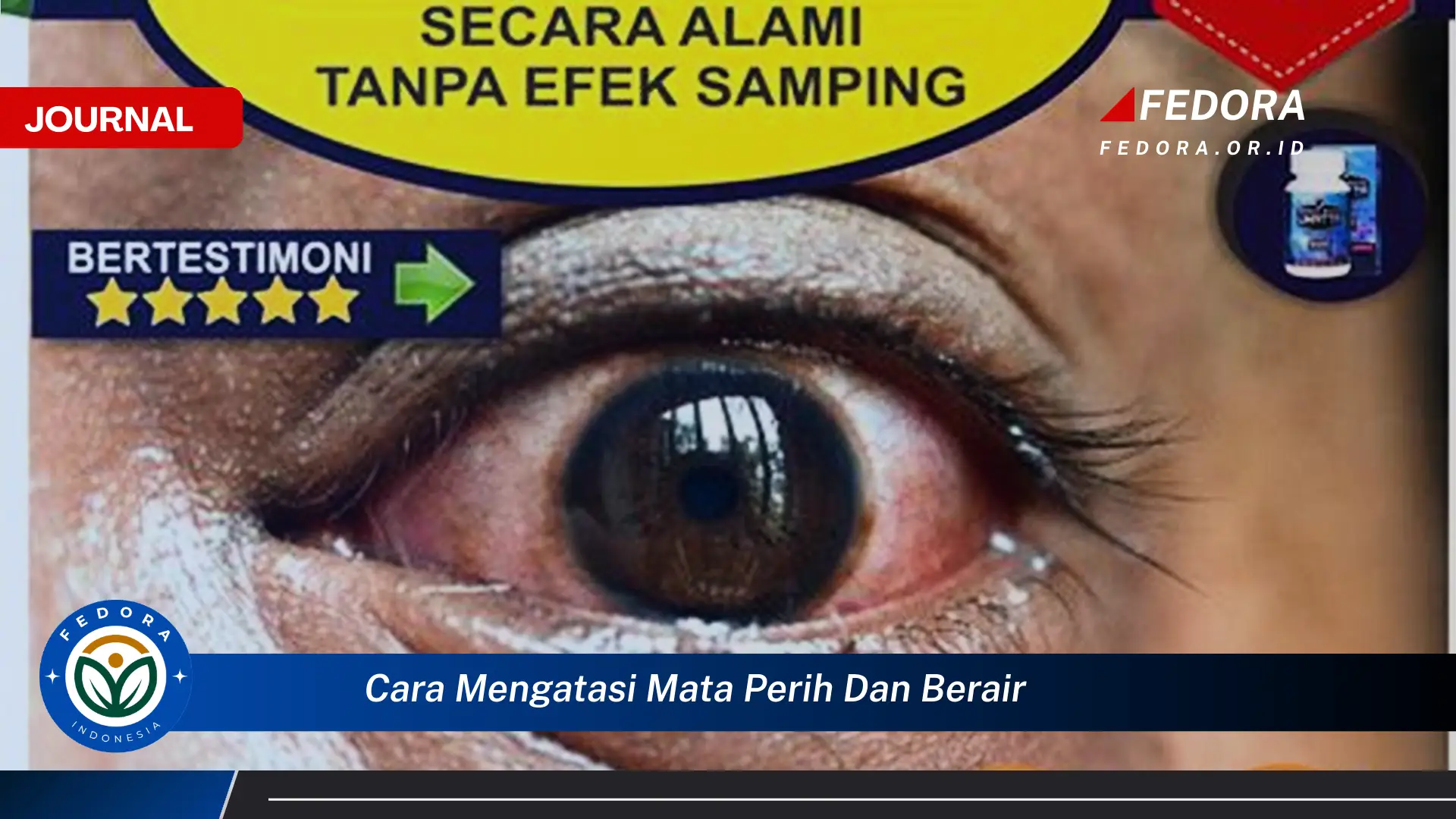Ketahui Cara Mengatasi Mata Perih dan Berair dengan Cepat dan Alami