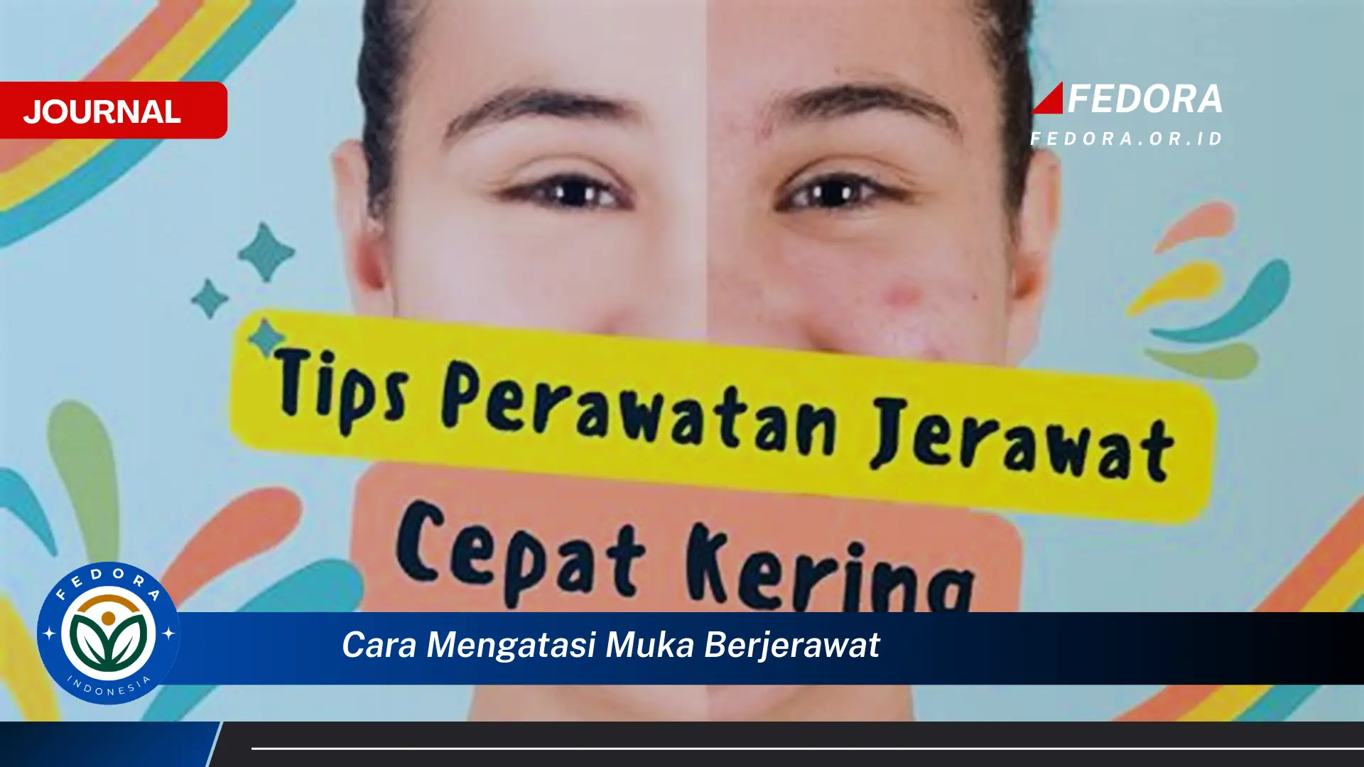 Ketahui Cara Mengatasi Muka Berjerawat dengan Cepat dan Ampuh