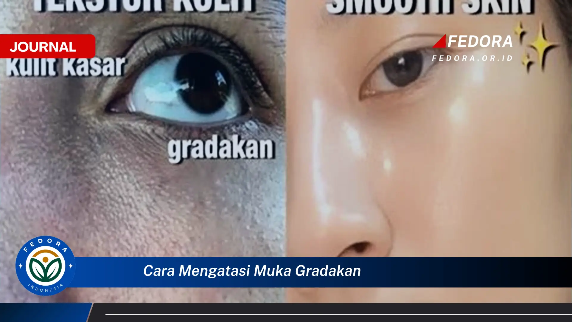 Ketahui Cara Mengatasi Muka Gradakan dengan Cepat dan Alami