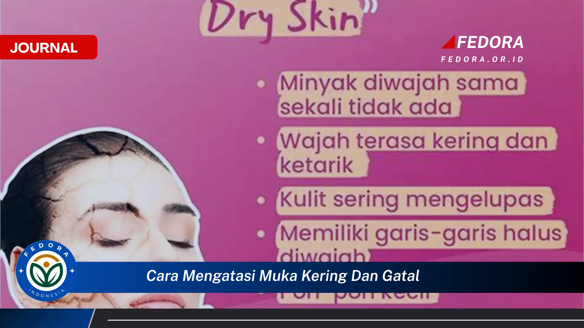 Ketahui Cara Mengatasi Muka Kering dan Gatal Secara Alami dan Efektif