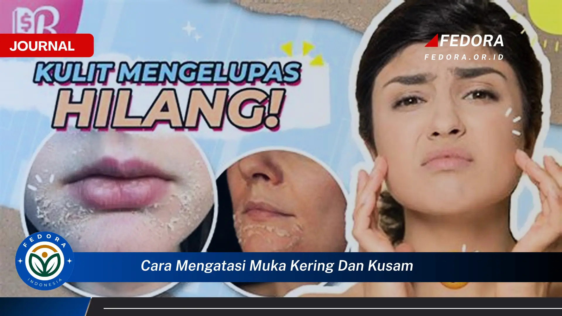 Ketahui Cara Mengatasi Muka Kering dan Kusam Secara Alami dan Efektif